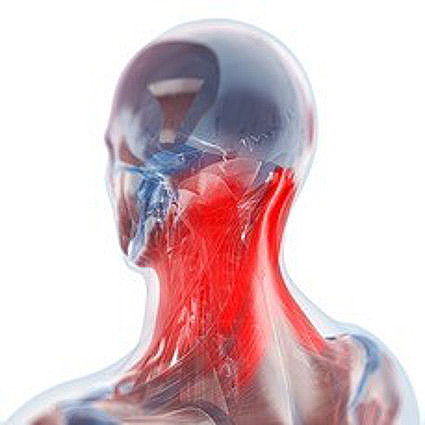 Dolore cervicale esercizi e rimedi contro il dolore al collo